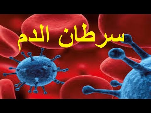 اعراض سرطان الدم - اللوكيميا اسبابه ومظاهر الاصابه به 466 2