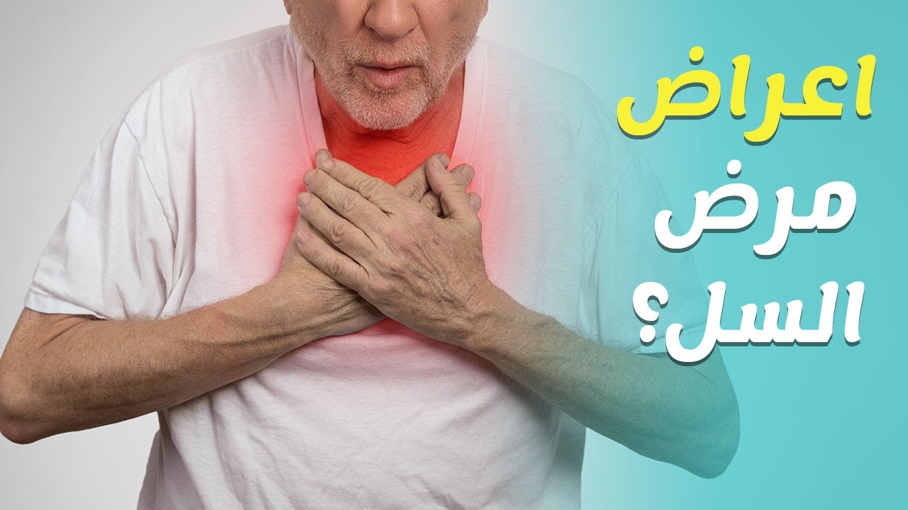 علاج مرض السل- اتبع العلاج بصوره منتظمه وسليمه 87 1