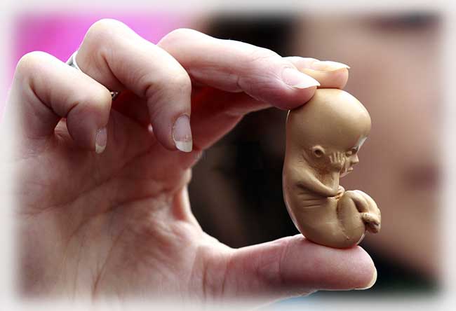 اجهاض الجنين , حكم الدين في اجهاض الجنين - عالم ستات